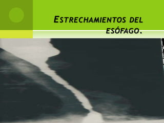 Estrechamientos del esófago.