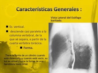 Características Generales :Vista Lateral del Esófago baritado.Es  vertical.desciende casi paralelo a la columna vertebral, de la que se separa, a partir de la cuarta vertebra torácica.Forma.