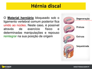 O Material herniário bloqueado sob o
ligamento vertebral comum posterior fica
unido ao núcleo. Neste caso, é possível
através de exercício físico e
determinadas manipulações e repouso
reintegrar na sua posição de origem
Hérnia discal
 