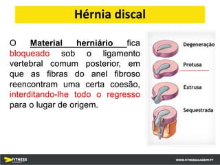 O Material herniário fica
bloqueado sob o ligamento
vertebral comum posterior, em
que as fibras do anel fibroso
reencontram uma certa coesão,
interditando-lhe todo o regresso
para o lugar de origem.
Hérnia discal
 