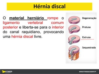 O material herniário rompe o
ligamento vertebral comum
posterior e liberta-se para o interior
do canal raquidiano, provocando
uma hérnia discal livre.
Hérnia discal
 