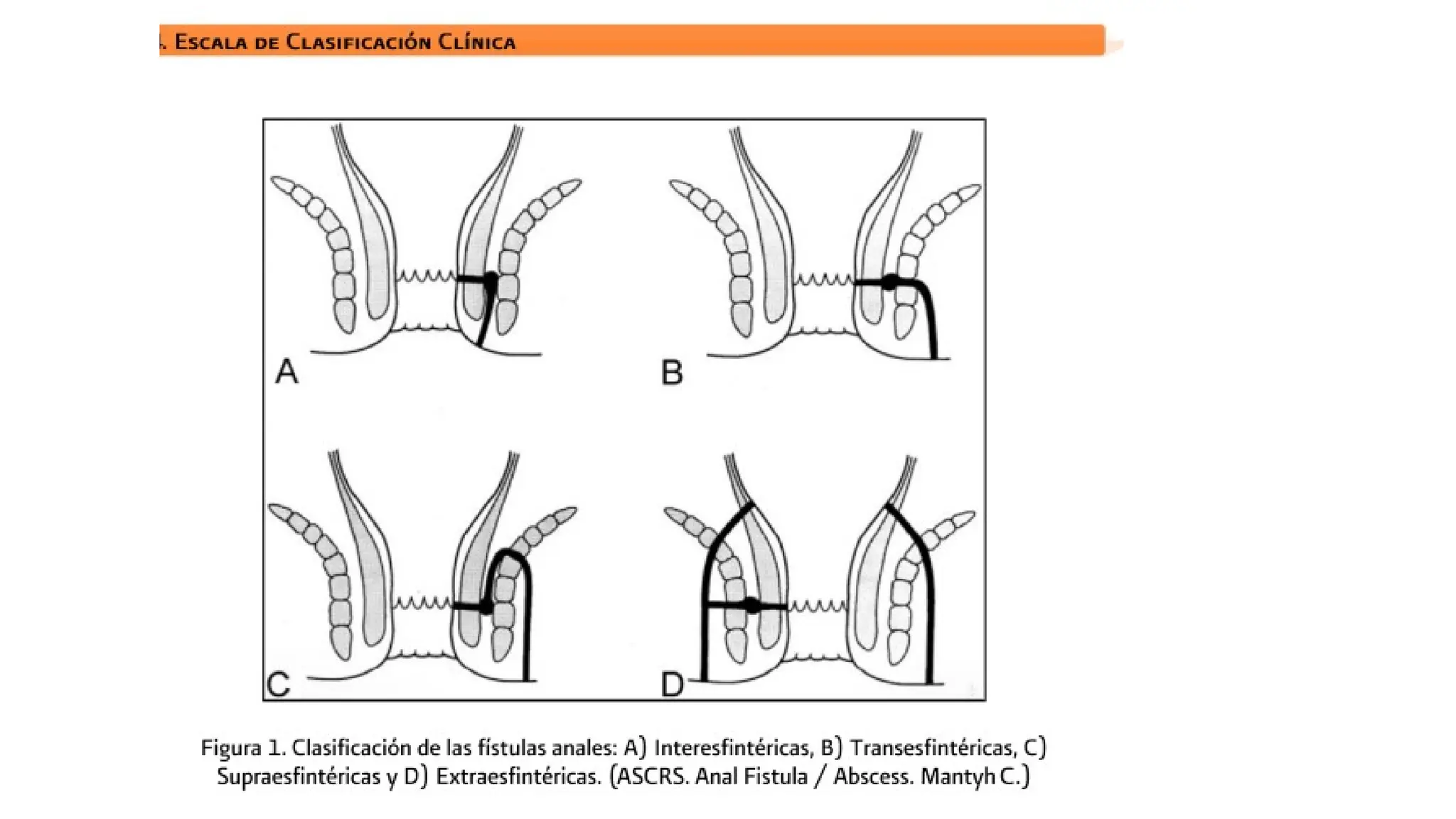 ANATOMIA, FISIOLOGIA DE RECTO Y ANO.pptx