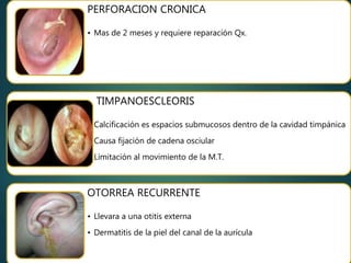 Anatomia Fisiologia y patologia del Oido