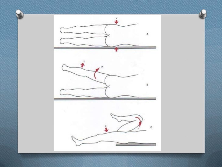 Anatomia funcional de la cadera Anatomia funcional de la cadera