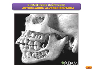 27
SINARTROSIS (GÓNFOSIS)
ARTICULACIÓN ALVEOLO DENTARIA
 