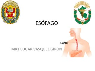 ESÓFAGO
MR1 EDGAR VASQUEZ GIRON
 