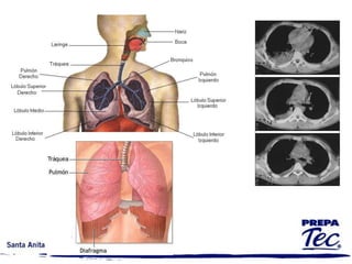 TERMINOLOGÍA MEDICA Y ANATÓMICA