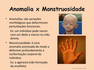 Anomalia x Monstruosidade
• Anomalias: são variações
  morfológicas que determinam
  perturbações funcionais.
   Ex: um indivíduo pode nascer
   com um dedo a menos na mão
   direita.
• Monstruosidade: é uma
  anomalia acentuada de modo a
  deformar profundamente a
  conformação corporal do
  individuo.
   Ex: a agenesia (não formação
   do encéfalo)
                                  Profa. ISAMAR CABRAL
 