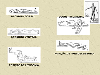 DECÚBITO DORSAL
DECÚBITO VENTRAL
DECÚBITO LATERAL
POSIÇÃO DE LITOTOMIA
POSIÇÃO DE TRENDELEMBURG
 