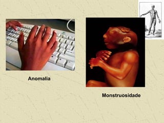 Anomalia
Monstruosidade
 