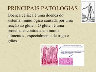 PRINCIPAIS PATOLOGIAS
Doença celíaca é uma doença do
sistema imunológico causada por uma
reação ao glúten. O glúten é uma
proteína encontrada em muitos
alimentos , especialmente de trigo e
grãos.
 