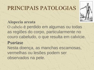 PRINCIPAIS PATOLOGIAS
Alopecia areata
O cabelo é perdido em algumas ou todas
as regiões do corpo, particularmente no
couro cabeludo, o que resulta em calvície.
Psoríase
Nesta doença, as manchas escamosas,
vermelhas ou lesões podem ser
observados na pele.
 
