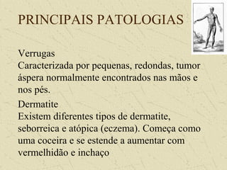 PRINCIPAIS PATOLOGIAS
Verrugas
Caracterizada por pequenas, redondas, tumor
áspera normalmente encontrados nas mãos e
nos pés.
Dermatite
Existem diferentes tipos de dermatite,
seborreica e atópica (eczema). Começa como
uma coceira e se estende a aumentar com
vermelhidão e inchaço
 