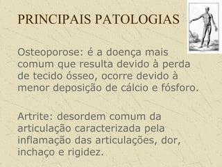 PRINCIPAIS PATOLOGIAS
Osteoporose: é a doença mais
comum que resulta devido à perda
de tecido ósseo, ocorre devido à
menor deposição de cálcio e fósforo.
Artrite: desordem comum da
articulação caracterizada pela
inflamação das articulações, dor,
inchaço e rigidez.
 