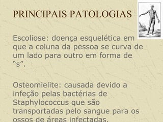 PRINCIPAIS PATOLOGIAS
Escoliose: doença esquelética em
que a coluna da pessoa se curva de
um lado para outro em forma de
“s”.
Osteomielite: causada devido a
infeção pelas bactérias de
Staphylococcus que são
transportadas pelo sangue para os
 