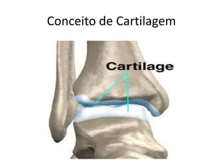 Conceito de Cartilagem
 
