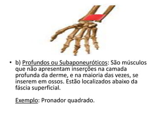 • b) Profundos ou Subaponeuróticos: São músculos
que não apresentam inserções na camada
profunda da derme, e na maioria das vezes, se
inserem em ossos. Estão localizados abaixo da
fáscia superficial.
Exemplo: Pronador quadrado.
 