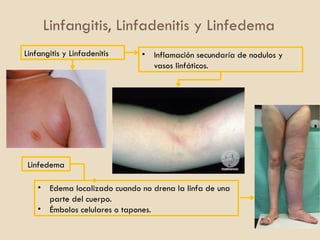 Linfangitis Reticular ANATOMIA HUMANA TEMA 3.sistemas de la anatomia | PPTX