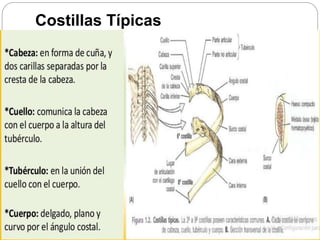 Costillas Típicas
 