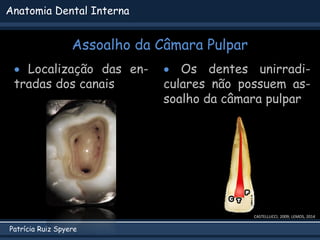 Patrícia Ruiz Spyere
Anatomia Dental Interna
Assoalho da Câmara Pulpar
 Localização das en-
tradas dos canais
CASTELLUCCI, 2009; LEMOS, 2014
 Os dentes unirradi-
culares não possuem as-
soalho da câmara pulpar
 