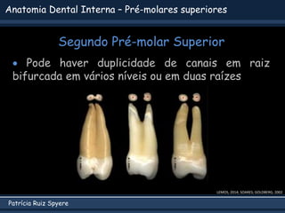 Patrícia Ruiz Spyere
Anatomia Dental Interna – Pré-molares superiores
Segundo Pré-molar Superior
LEMOS, 2014; SOARES; GOLDBERG, 2002
 Pode haver duplicidade de canais em raiz
bifurcada em vários níveis ou em duas raízes
 