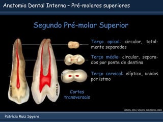 Patrícia Ruiz Spyere
Anatomia Dental Interna – Pré-molares superiores
Segundo Pré-molar Superior
LEMOS, 2014; SOARES; GOLDBERG, 2002
Cortes
transversais
Terço apical: circular, total-
mente separados
Terço médio: circular, separa-
dos por ponte de dentina
Terço cervical: elíptica, unidos
por istmo
 