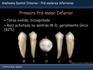Patrícia Ruiz Spyere
Anatomia Dental Interna – Pré-molares inferiores
Primeiro Pré-molar Inferior
 Coroa ovóide, bicuspidada
 Raiz achatada no sentido M-D, geralmente única
(82%)
LEMOS, 2014; SOARES; GOLDBERG, 2002
V L D
M O
V
L
 