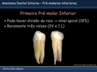 Patrícia Ruiz Spyere
Anatomia Dental Interna – Pré-molares inferiores
Primeiro Pré-molar Inferior
 Pode haver divisão da raiz  nível apical (18%)
 Raramente três raízes (2V e 1 L)
LEMOS, 2014; SOARES; GOLDBERG, 2002
 