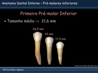 Patrícia Ruiz Spyere
Anatomia Dental Interna – Pré-molares inferiores
Primeiro Pré-molar Inferior
 Tamanho médio  21,6 mm
LEMOS, 2014; SOARES; GOLDBERG, 2002
22 mm
17,5 mm
26,5 mm
 