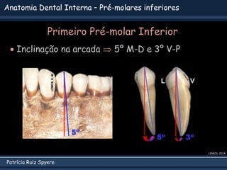 Patrícia Ruiz Spyere
Anatomia Dental Interna – Pré-molares inferiores
Primeiro Pré-molar Inferior
 Inclinação na arcada  5º M-D e 3º V-P
LEMOS, 2014
 