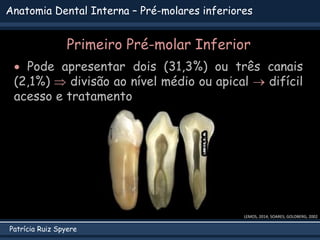 Patrícia Ruiz Spyere
Anatomia Dental Interna – Pré-molares inferiores
Primeiro Pré-molar Inferior
 Pode apresentar dois (31,3%) ou três canais
(2,1%)  divisão ao nível médio ou apical  difícil
acesso e tratamento
LEMOS, 2014; SOARES; GOLDBERG, 2002
 