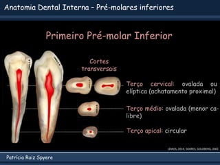 Patrícia Ruiz Spyere
Anatomia Dental Interna – Pré-molares inferiores
Primeiro Pré-molar Inferior
LEMOS, 2014; SOARES; GOLDBERG, 2002
Cortes
transversais
Terço apical: circular
Terço médio: ovalada (menor ca-
libre)
Terço cervical: ovalada ou
elíptica (achatamento proximal)
 