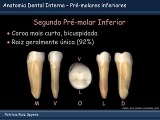 Patrícia Ruiz Spyere
Anatomia Dental Interna – Pré-molares inferiores
Segundo Pré-molar Inferior
 Coroa mais curta, bicuspidada
 Raiz geralmente única (92%)
LEMOS, 2014; SOARES; GOLDBERG, 2002
V L D
M O
V
L
 
