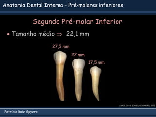 Patrícia Ruiz Spyere
Anatomia Dental Interna – Pré-molares inferiores
Segundo Pré-molar Inferior
 Tamanho médio  22,1 mm
LEMOS, 2014; SOARES; GOLDBERG, 2002
22 mm
17,5 mm
27,5 mm
 
