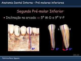 Patrícia Ruiz Spyere
Anatomia Dental Interna – Pré-molares inferiores
Segundo Pré-molar Inferior
 Inclinação na arcada  5º M-D e 9º V-P
LEMOS, 2014
 