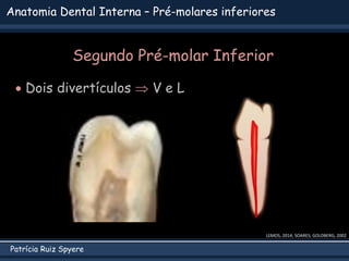 Patrícia Ruiz Spyere
Anatomia Dental Interna – Pré-molares inferiores
Segundo Pré-molar Inferior
 Dois divertículos  V e L
LEMOS, 2014; SOARES; GOLDBERG, 2002
 