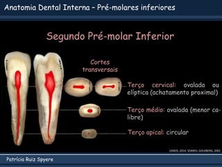 Patrícia Ruiz Spyere
Anatomia Dental Interna – Pré-molares inferiores
Segundo Pré-molar Inferior
LEMOS, 2014; SOARES; GOLDBERG, 2002
Cortes
transversais
Terço apical: circular
Terço médio: ovalada (menor ca-
libre)
Terço cervical: ovalada ou
elíptica (achatamento proximal)
 