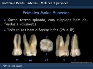 Patrícia Ruiz Spyere
Anatomia Dental Interna – Molares superiores
Primeiro Molar Superior
LEMOS, 2014; SOARES; GOLDBERG, 2002
 Coroa tetracuspidada, com cúspides bem de-
finidas e volumosas
 Três raízes bem diferenciadas (2V e 1P)
V P
D
M O
V
P
 