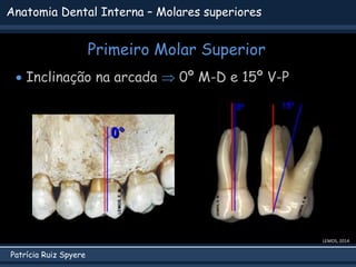 Patrícia Ruiz Spyere
Anatomia Dental Interna – Molares superiores
Primeiro Molar Superior
LEMOS, 2014
 Inclinação na arcada  0º M-D e 15º V-P
 
