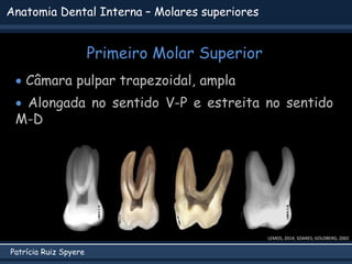 Patrícia Ruiz Spyere
Anatomia Dental Interna – Molares superiores
Primeiro Molar Superior
LEMOS, 2014; SOARES; GOLDBERG, 2002
 Câmara pulpar trapezoidal, ampla
 Alongada no sentido V-P e estreita no sentido
M-D
 
