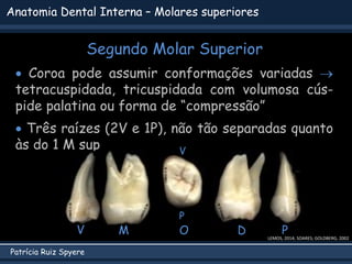 Patrícia Ruiz Spyere
Anatomia Dental Interna – Molares superiores
Segundo Molar Superior
 Coroa pode assumir conformações variadas 
tetracuspidada, tricuspidada com volumosa cús-
pide palatina ou forma de “compressão”
 Três raízes (2V e 1P), não tão separadas quanto
às do 1 M sup
LEMOS, 2014; SOARES; GOLDBERG, 2002
V P
D
M O
V
P
 