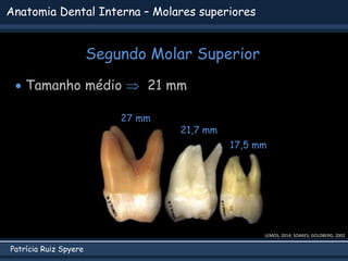 Patrícia Ruiz Spyere
Anatomia Dental Interna – Molares superiores
Segundo Molar Superior
LEMOS, 2014; SOARES; GOLDBERG, 2002
 Tamanho médio  21 mm
27 mm
21,7 mm
17,5 mm
 
