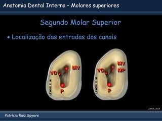 Patrícia Ruiz Spyere
Anatomia Dental Interna – Molares superiores
Segundo Molar Superior
LEMOS, 2014
 Localização das entradas dos canais
 