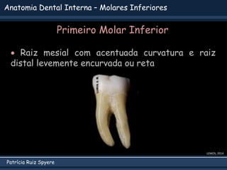 Patrícia Ruiz Spyere
Anatomia Dental Interna – Molares Inferiores
LEMOS, 2014
 Raiz mesial com acentuada curvatura e raiz
distal levemente encurvada ou reta
Primeiro Molar Inferior
 