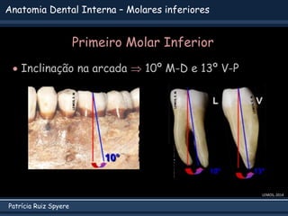Patrícia Ruiz Spyere
Anatomia Dental Interna – Molares inferiores
 Inclinação na arcada  10º M-D e 13º V-P
LEMOS, 2014
Primeiro Molar Inferior
 