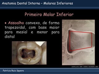 Patrícia Ruiz Spyere
Anatomia Dental Interna – Molares Inferiores
CASTELLUCCI, 2009 ; SOARES; GOLDBERG, 2002
 Assoalho convexo, de forma
trapezoidal, com base maior
para mesial e menor para
distal
Primeiro Molar Inferior
 