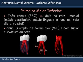 Patrícia Ruiz Spyere
Anatomia Dental Interna – Molares Inferiores
 Três canais (56%)  dois na raiz mesial
(mésio-vestibular, mésio-lingual) e um na raiz
distal (distal)
 Canal D amplo, de forma oval (V-L) e com suave
curvatura ou reto
SOARES; GOLDBERG, 2002; VERSIANI, 2014
MV
ML D
Primeiro Molar Inferior
 