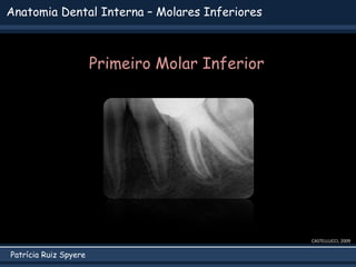 Patrícia Ruiz Spyere
Anatomia Dental Interna – Molares Inferiores
CASTELLUCCI, 2009
Primeiro Molar Inferior
 