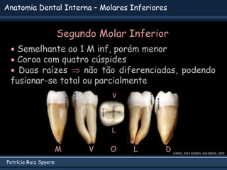 Patrícia Ruiz Spyere
Anatomia Dental Interna – Molares Inferiores
LEMOS, 2014 SOARES; GOLDBERG, 2002
Segundo Molar Inferior
 Semelhante ao 1 M inf, porém menor
 Coroa com quatro cúspides
 Duas raízes  não tão diferenciadas, podendo
fusionar-se total ou parcialmente
V L D
M O
L
V
 