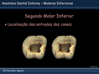 Patrícia Ruiz Spyere
Anatomia Dental Interna – Molares Inferiores
LEMOS, 2014
 Localização das entradas dos canais
Segundo Molar Inferior
 